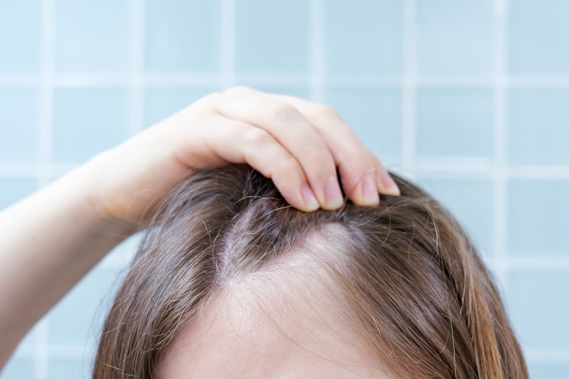 Tricopigmentation Montbonnot Gières